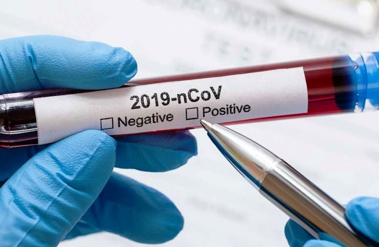 Ковид 19 - тест