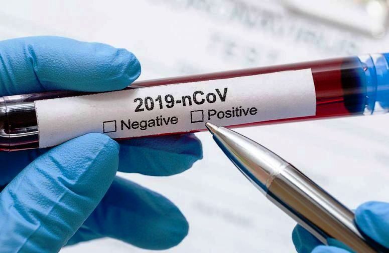 Ковид 19 - тест