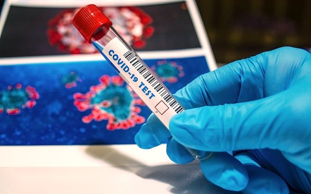Koronavirus-44-Fernando-Zhiminaicela